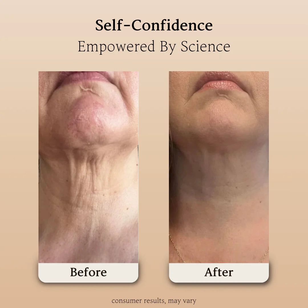 Mezzora™ NeckLift Roller Cream