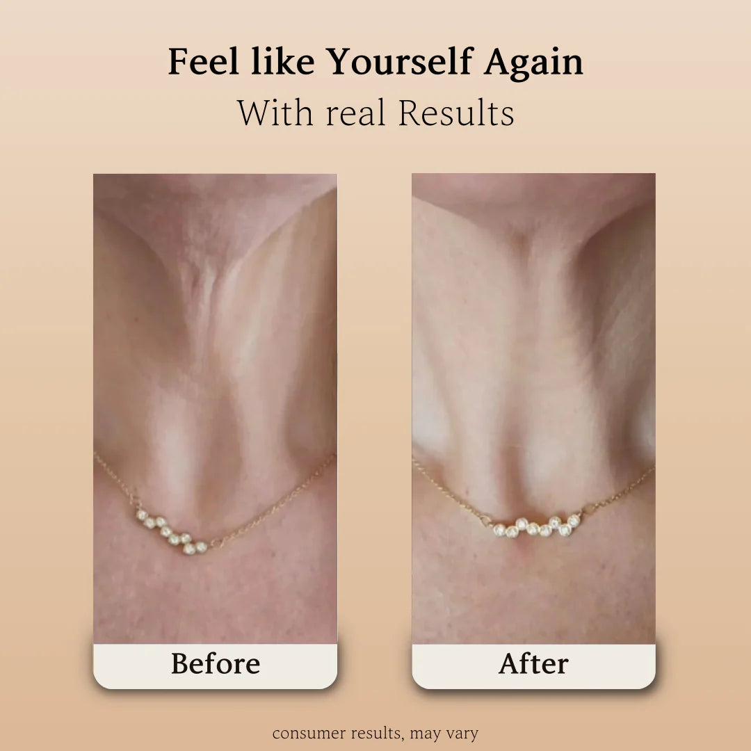 Mezzora™ NeckLift Roller Cream